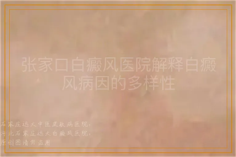张家口白癜风医院解释白癜风病因的多样性