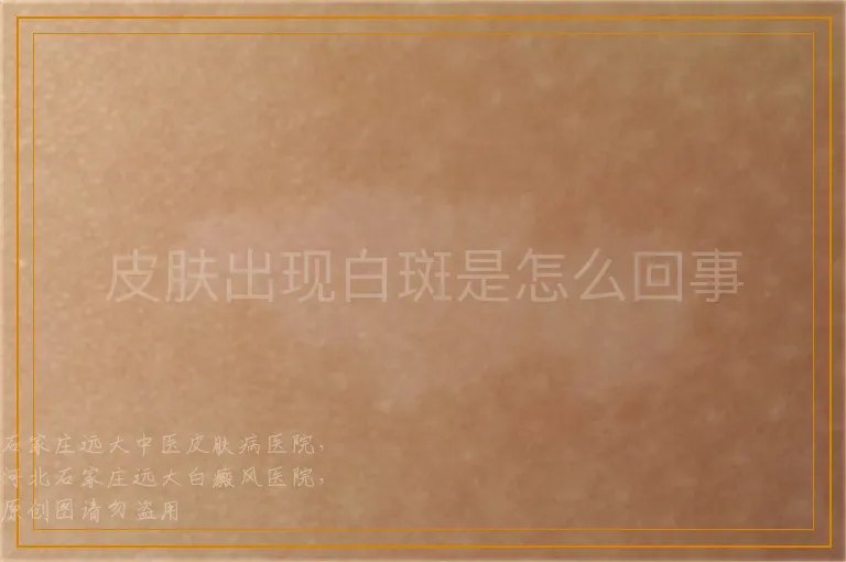 皮肤出现白斑是怎么回事