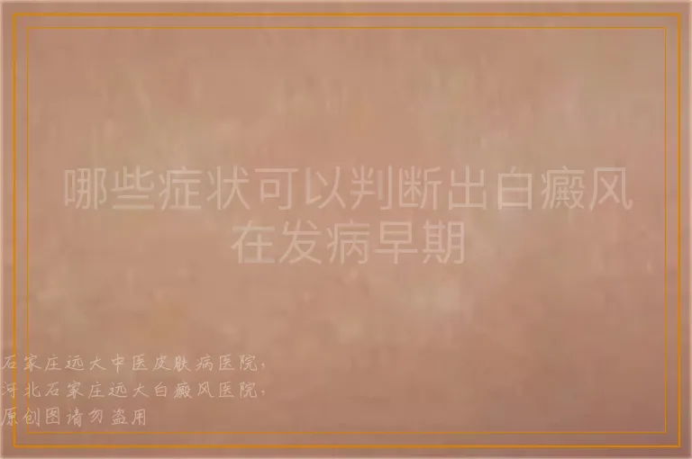 哪些症状可以判断出白癜风在发病早期