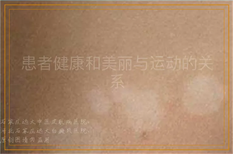 患者健康和美丽与运动的关系