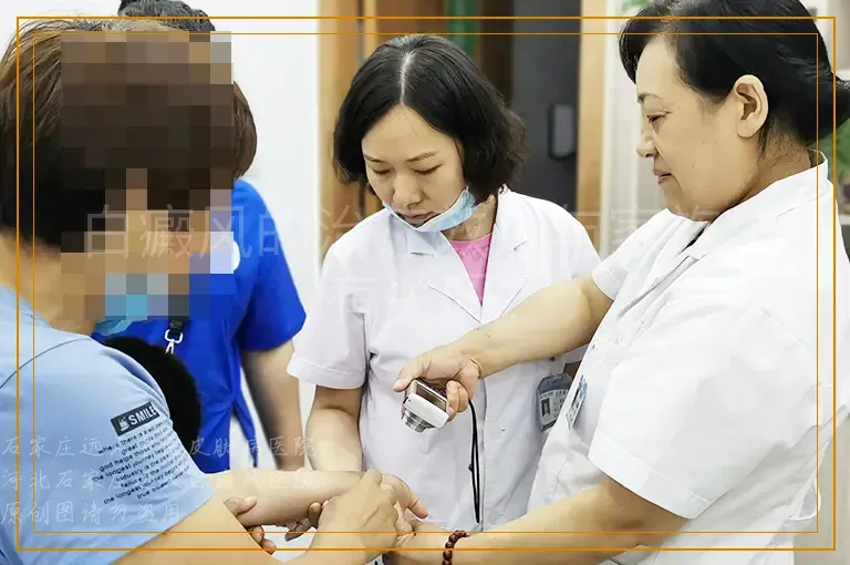 白癜风的治疗效果与家族史有关吗？