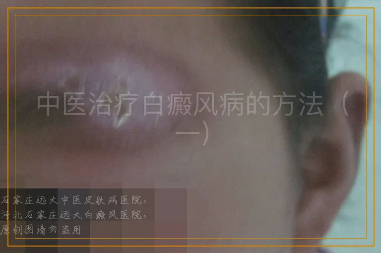 中医治疗白癜风病的方法（一）
