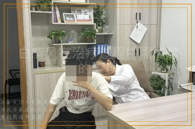白癜风在治疗过程中需注意的事项