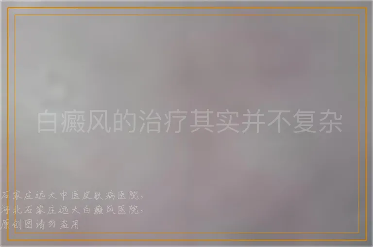 白癜风的治疗其实并不复杂