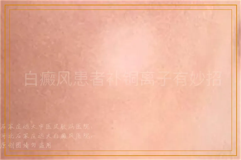 白癜风患者补铜离子有妙招