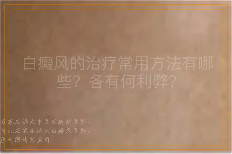 白癜风的治疗常用方法有哪些？各有何利弊？