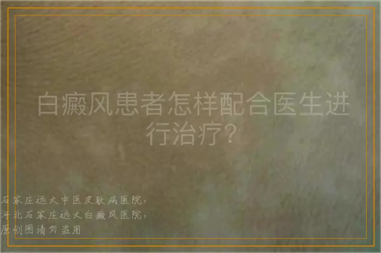 白癜风患者怎样配合医生进行治疗？