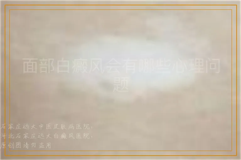 面部白癜风会有哪些心理问题