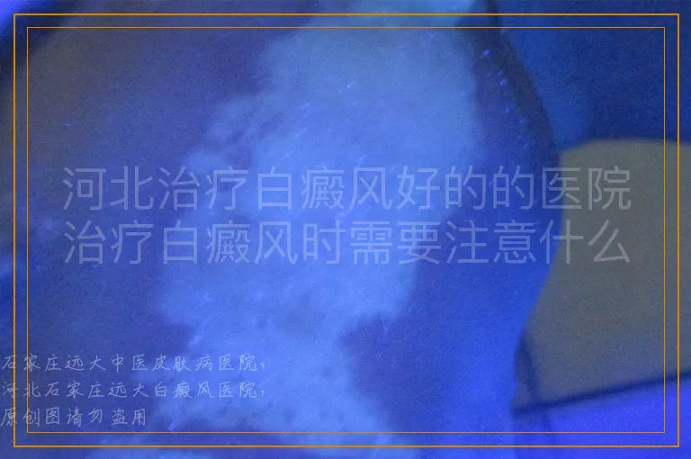 河北治疗白癜风好的的医院治疗白癜风时需要注意什么呢