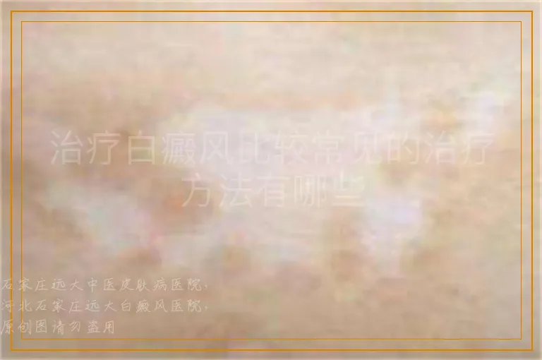 治疗白癜风比较常见的治疗方法有哪些