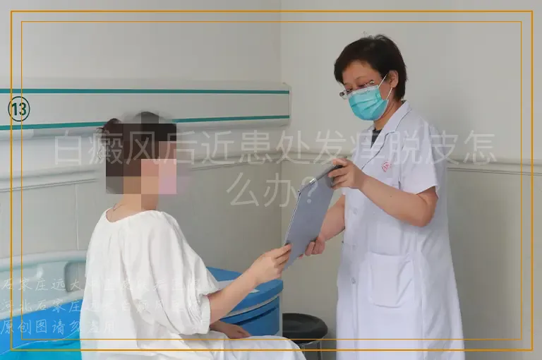 白癜风后近患处发痒脱皮怎么办?