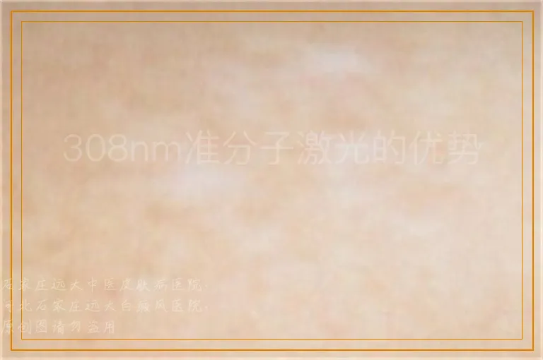 308nm准分子激光的优势
