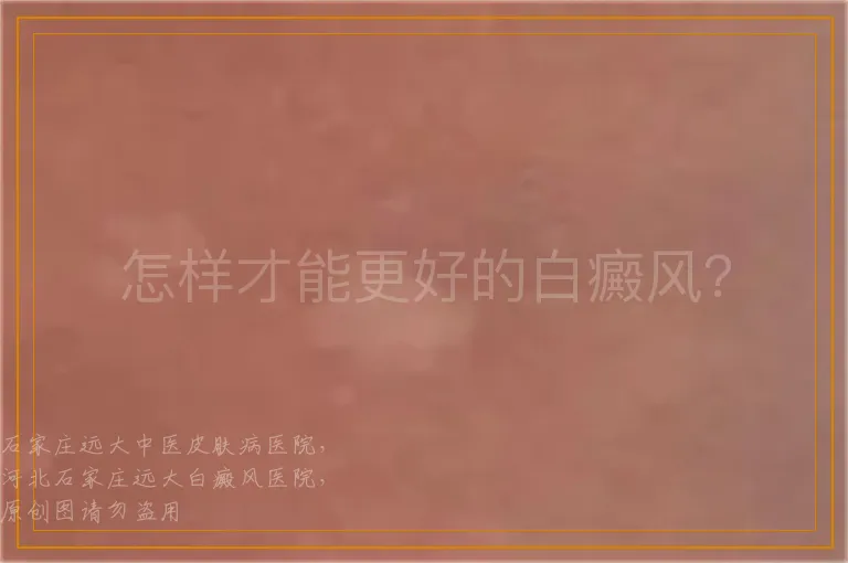 怎样才能更好的白癜风？