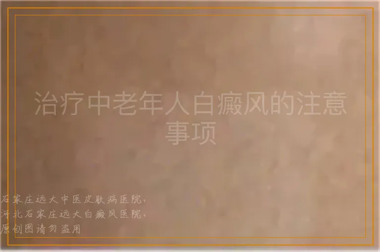 治疗中老年人白癜风的注意事项