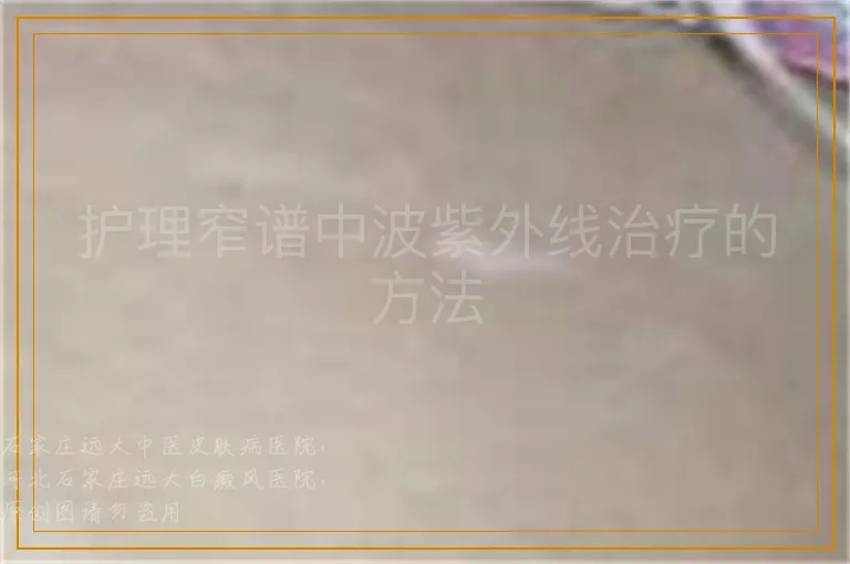 护理窄谱中波紫外线治疗的方法