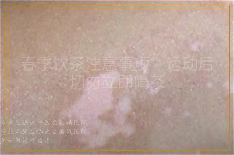 春季饮茶注意事项：运动后切勿立即喝茶