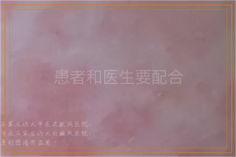 患者和医生要配合