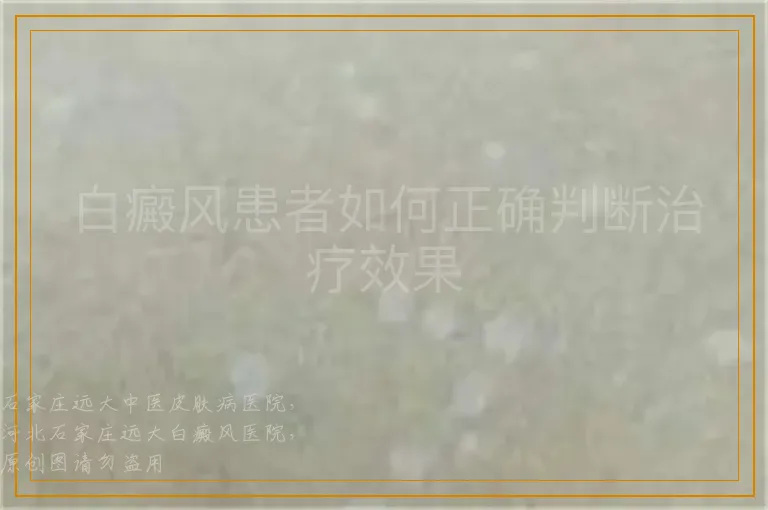 白癜风患者如何正确判断治疗效果