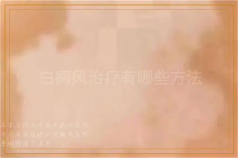白癜风治疗有哪些方法